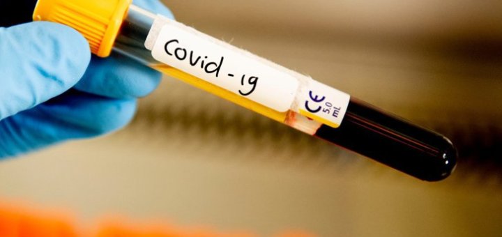Peste 100 de cazuri noi şi un deces provocat de COVID-19 în ultimele 24 de ore