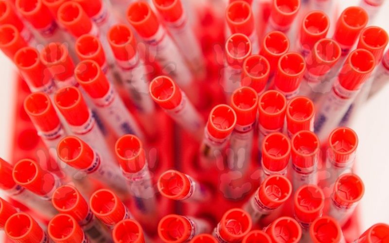 Danemarca limitează disponibilitatea testelor PCR din cauza numărului mare de solicitări