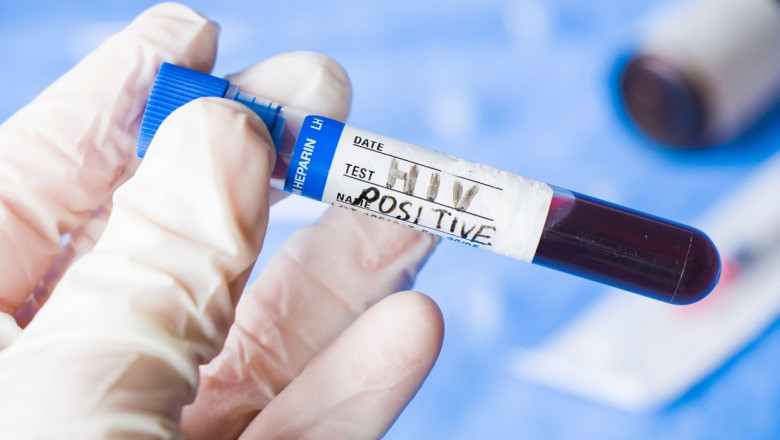 O echipă de cercetători a anunţat că este posibil să fi vindecat o femeie de HIV