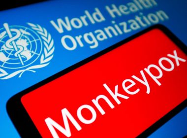 Variola maimuţei a fost depistată în 11 ţări. Şedinţă de urgenţă a OMS, răspândirea pe glob provoacă îngrijorare￼